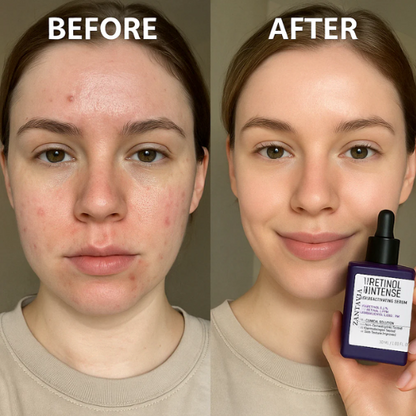 Zantavia's Retinol Reactivating Serum