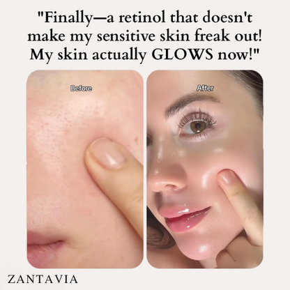 Zantavia's Retinol Reactivating Serum